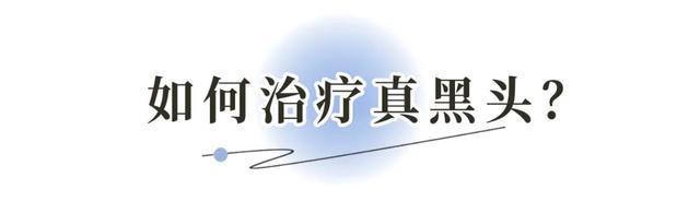 新观点(2024今晚新澳六我奖)夏日黑头困扰，超干货去黑头分享来啦  第22张