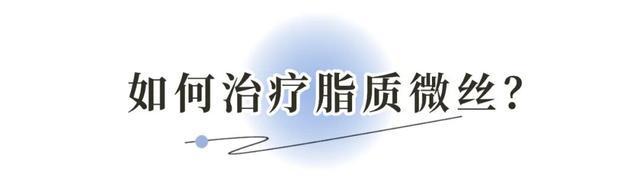 新观点(2024今晚新澳六我奖)夏日黑头困扰，超干货去黑头分享来啦  第24张