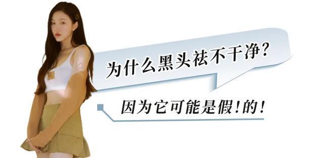 新观点(2024今晚新澳六我奖)夏日黑头困扰，超干货去黑头分享来啦  第4张