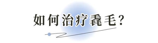 新观点(2024今晚新澳六我奖)夏日黑头困扰，超干货去黑头分享来啦  第42张